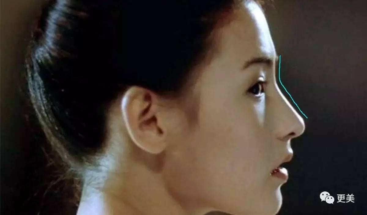 所长用她的照片画了线示意一下但像这样鼻子整体从山根到鼻尖都高的