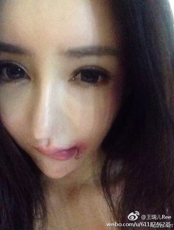 百万假胸遭家暴第一网红王瑞儿微博再发声