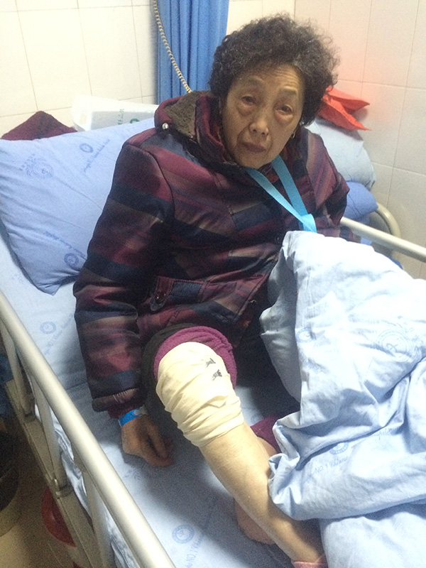 摔伤入院的陈仕梅。