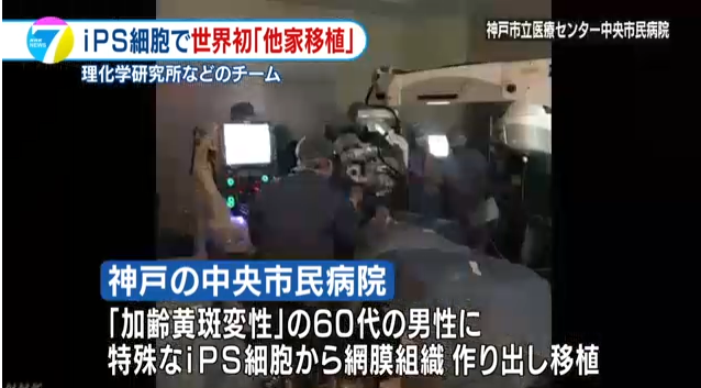 全球首例 日团队移植他人ips细胞制视网膜细胞 手机新浪网