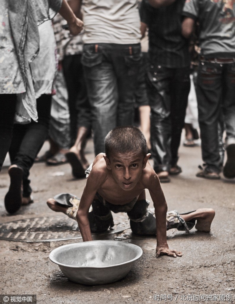 令人揪心这里的儿童枯瘦如柴在生死线上挣扎谋生