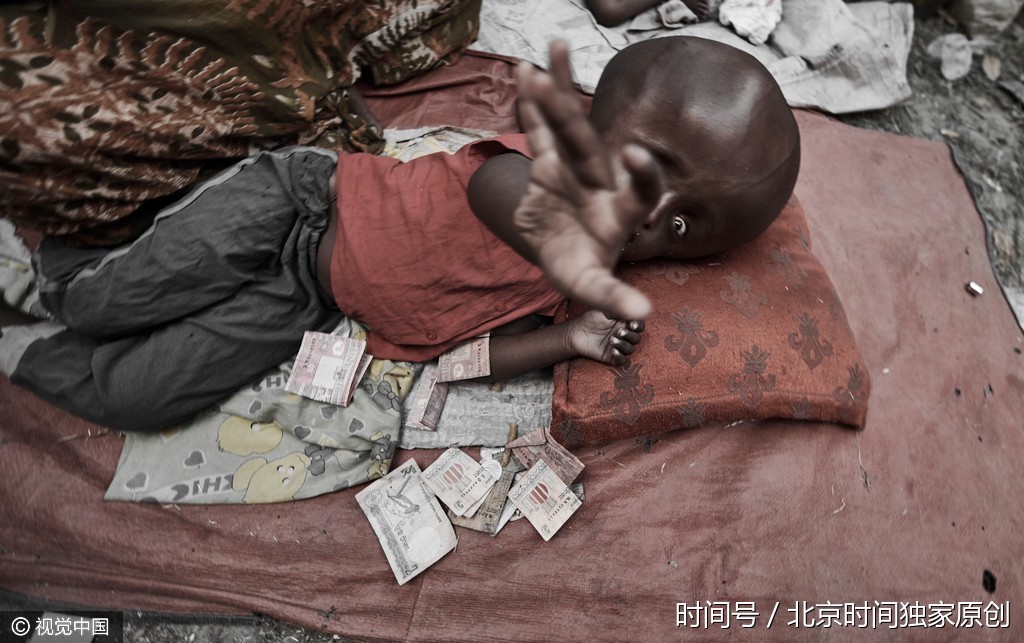 令人揪心这里的儿童枯瘦如柴在生死线上挣扎谋生