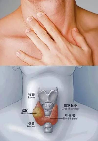 甲状腺是在什么位置图片