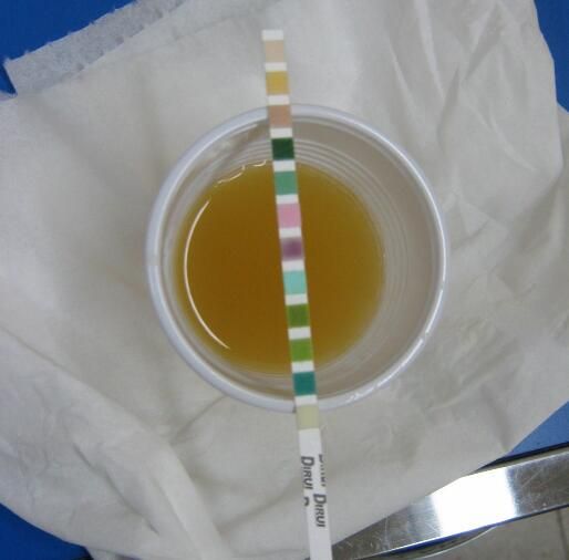 hiv|尿液|检测_新浪科技_新浪网