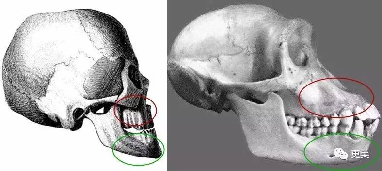 baby当年嘴凸像猩猩真不是牙套能解决的!