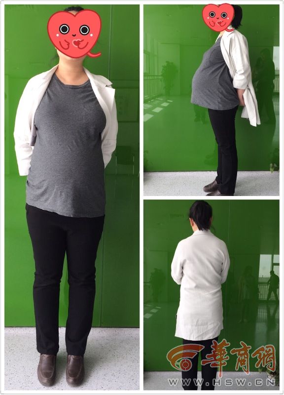 产六病区的孙女士肚子圆圆的会生女孩,肚子尖尖的会生男孩……靠妈妈