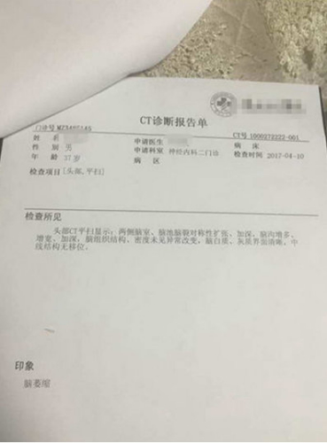 每天熬夜看手机致脑萎缩黑科技戒手机瘾有创意