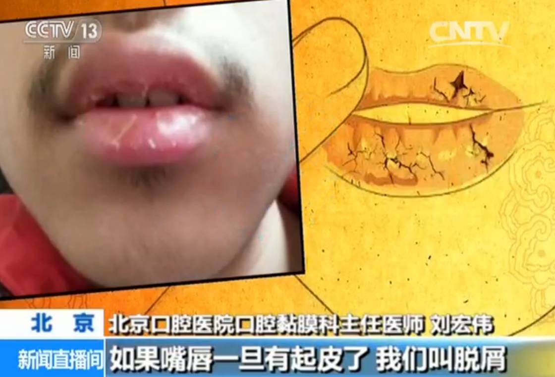 提醒 嘴唇干裂别再只喝水 涂唇膏啦 正确的做法是这样 手机新浪网 提醒 嘴唇干裂别再只喝水 涂唇膏啦 正确的做法是这样 手机新浪网