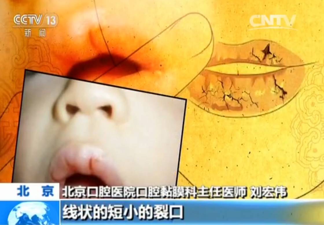 提醒 嘴唇干裂别再只喝水 涂唇膏啦 正确的做法是这样 手机新浪网 提醒 嘴唇干裂别再只喝水 涂唇膏啦 正确的做法是这样 手机新浪网