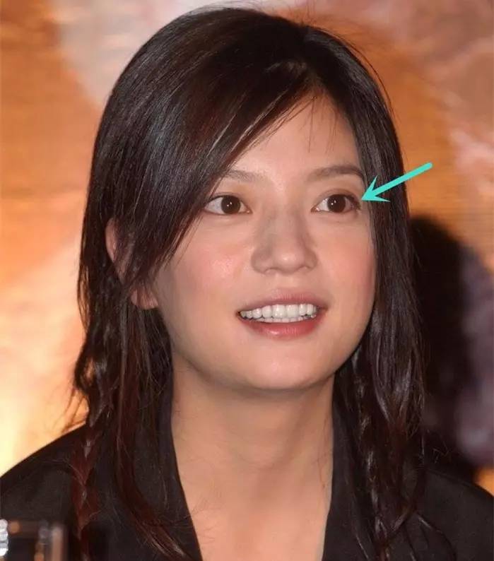 眼睛|单眼皮|眼袋_新浪女性_新浪网