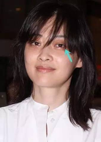 关关死鱼眼刘诗诗眼神不带戏目光呆滞也是种病