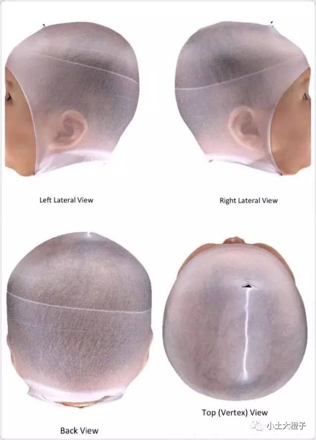 头型怎么样可以从以下四个角度用肉眼观察,但偏头的具体程度则需要从