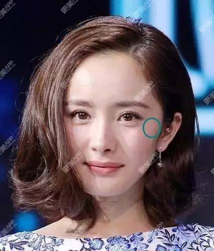 科普杨幂左脸疤痕为什么去不掉