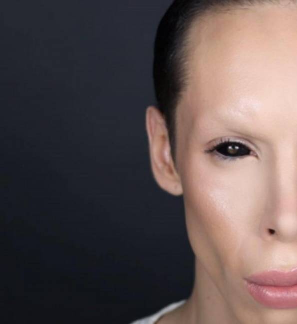 这12个外国顶级整容狂在真人秀不合简直盛况空前