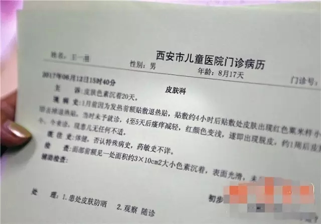 有儿童用后额头留黑印褪不掉