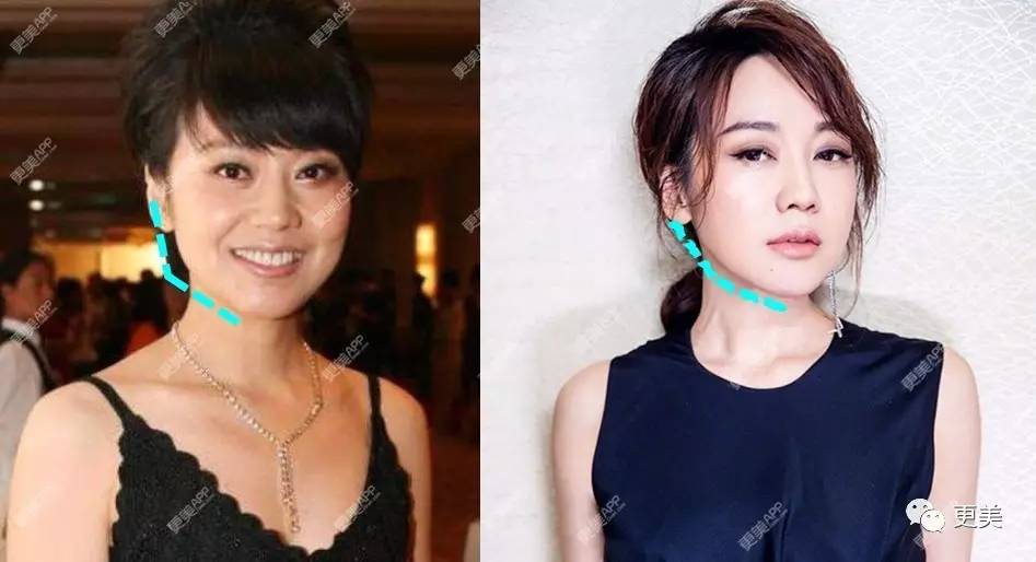 46岁闫妮身材堪比郑爽除了身材脸也发生了变化