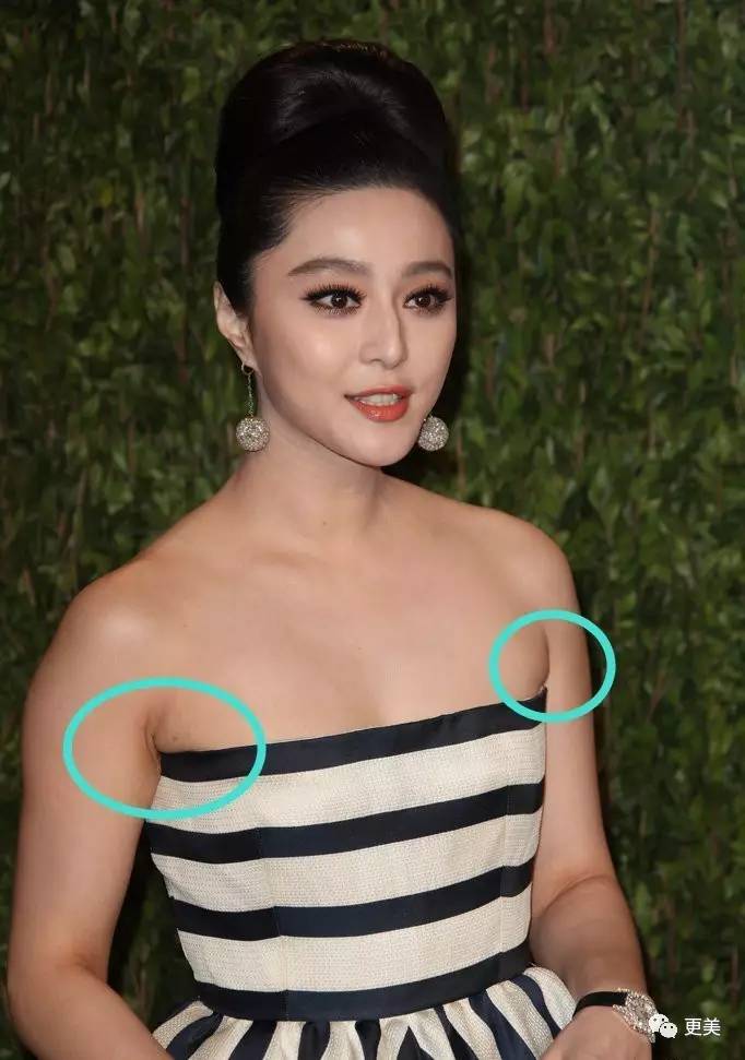 其实副乳是个非常常见的现象,范爷穿礼服的时候,就不慎露出过影响