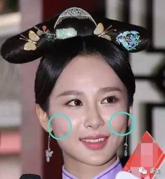 科普贴秋瓷炫宋慧乔成冻龄新娘全因苹果肌