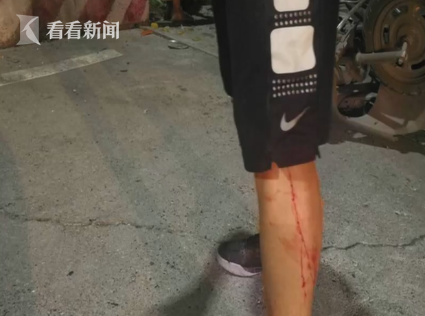 随后,赶到现场的120救护车将两位伤者送往医院进行救治.