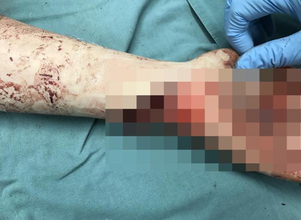 因房产纠纷女子被79岁继父砍三刀继父年纪大或被从轻处罚