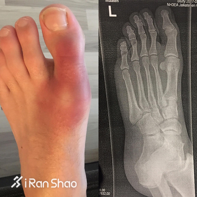 深度| 不一样的777挑战 7大洲7场超马只为7所学校募集善款