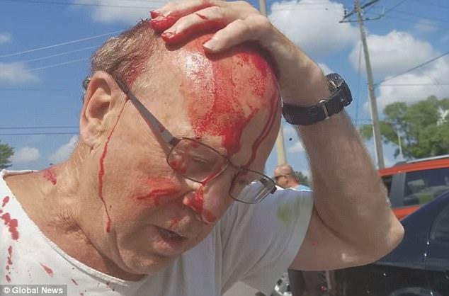 视频|头破血流!骑车左拐起冲突 加拿大74岁老头遭路怒司机痛打