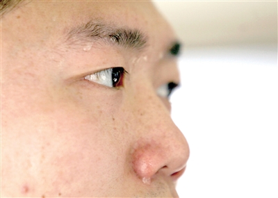 汗珠顺着额头往下滴.