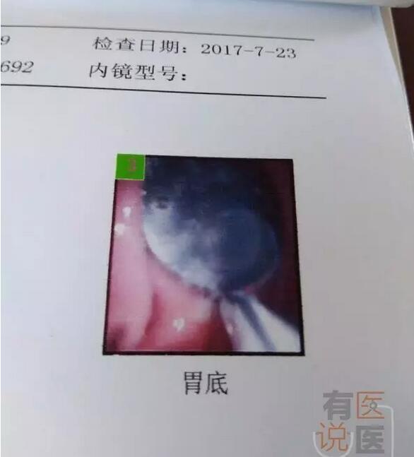 经过拍片检查,医生发现琪琪的胃里有一枚圆形异物,当即给她开了通