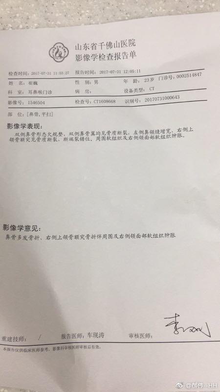组组长郝伟微博发布了一张检查报告,从图中可以得知,崔巍鼻骨多发骨折