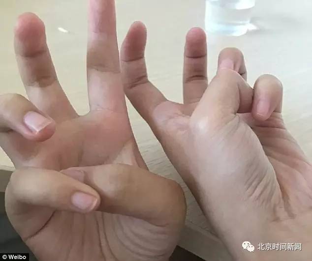 呵呵哒 这手势火到了国外你能做到吗 有网友骨折了 手机新浪网 呵呵哒 这手势火到了国外你能做到吗 有网友骨折了 手机新浪网