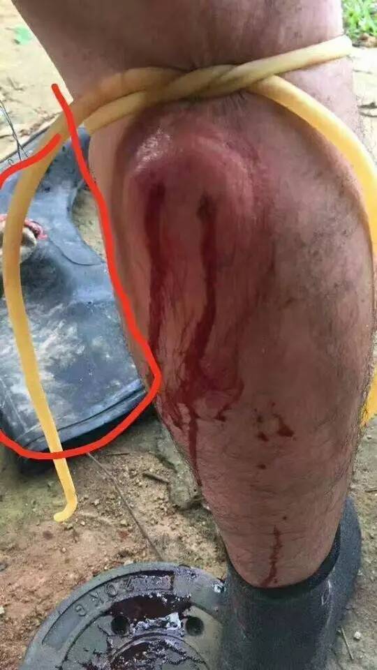 松桃深山村民河边钓鱼突然感觉腿部有针在扎伸手一摸竟然是血