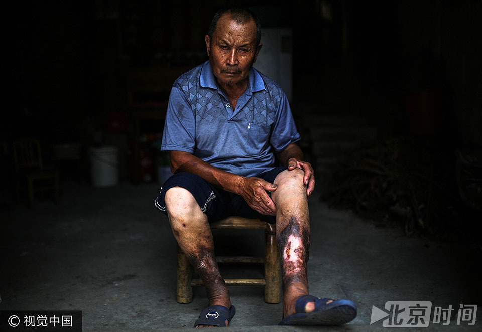 日军细菌战的24位中国受害者及遗属