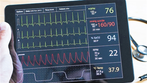 有效预测脑嘀柰