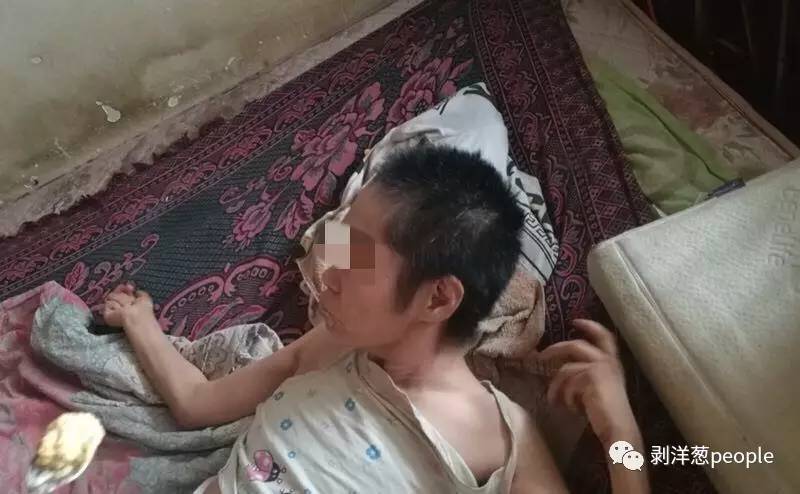 黑暗中的"舞者":亨廷顿舞蹈症群像