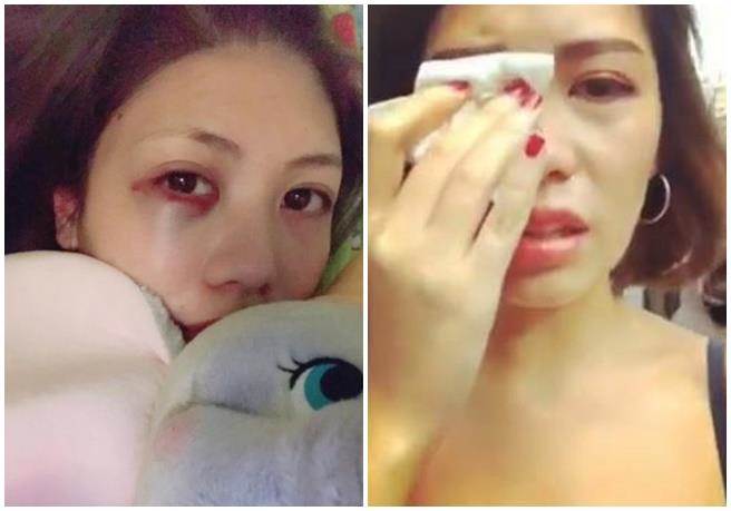 台湾女子游纽约莫名被黑人打肿脸怒批美歧视王国