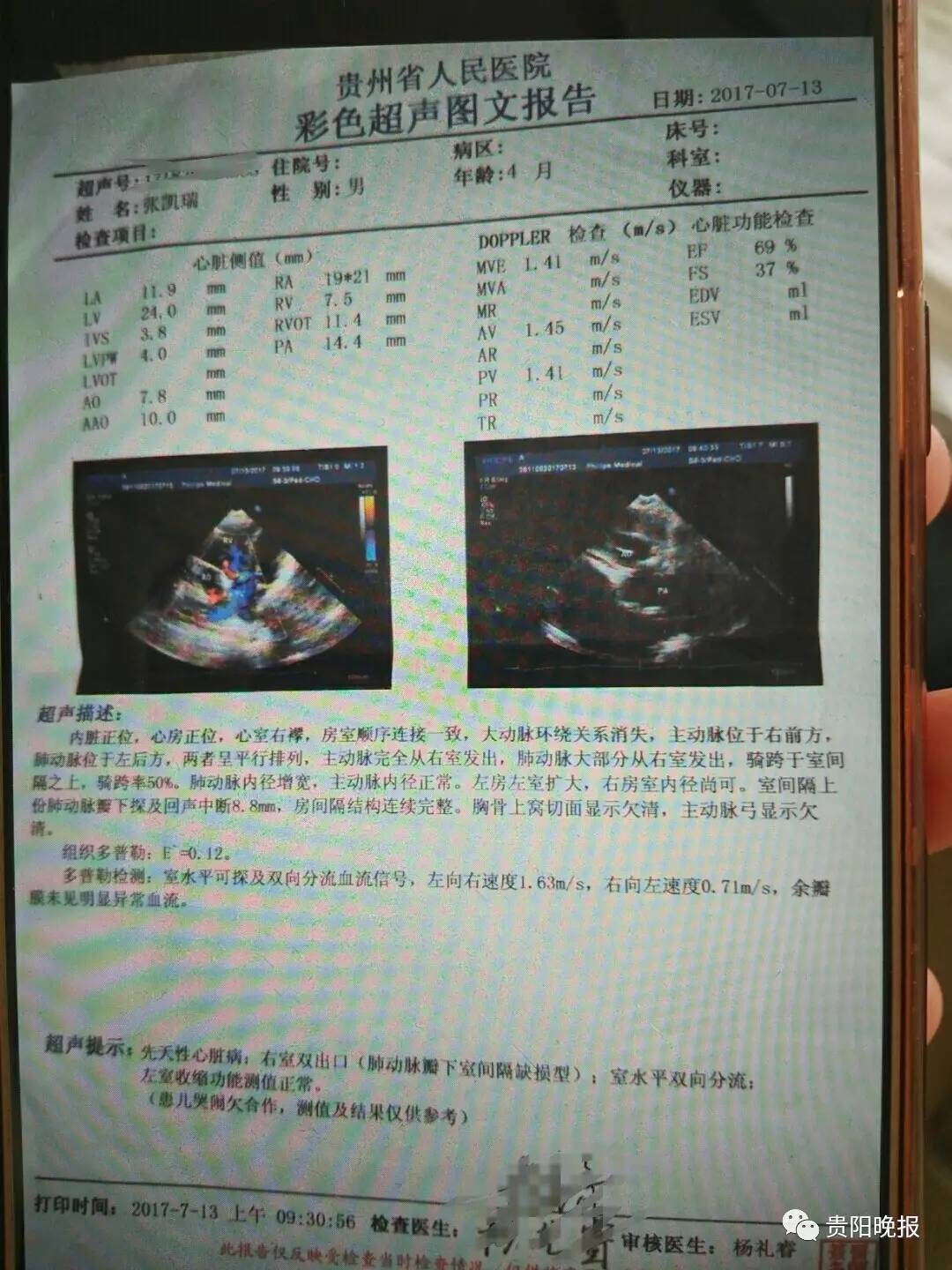 怀孕报告单图片 清晰图片