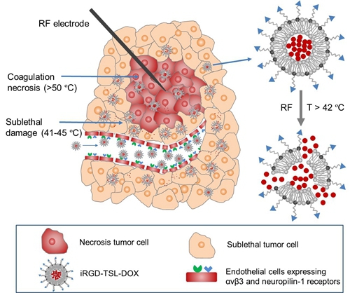 深圳先进院等在超声引导射频消融联合温控释药研究中获进展
