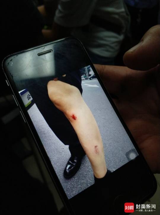 交警被女子当街撕咬大腿,事后还注射狂犬病疫苗!看完视频网友惊呆了