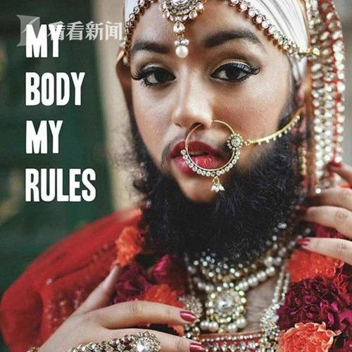 少女患怪病脸上长满胡子 却变身t台最美模特惊艳世界|胡子|t台|大胡子