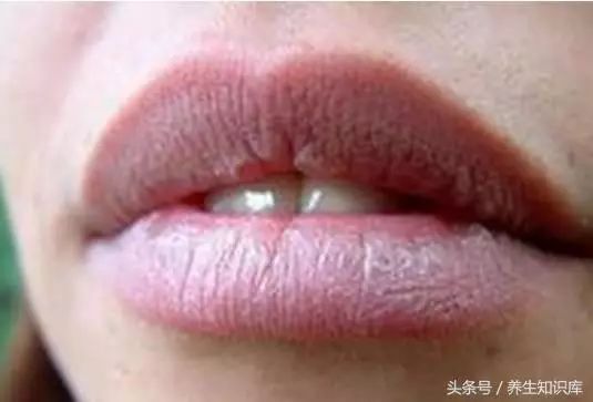 健康 5个信号说明你的血液已 粘稠如粥 手机新浪网