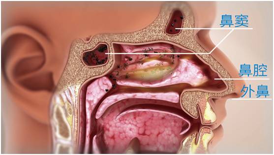 老公非要离婚 因为她睡着后让人难以忍受……|鼻炎|鼻窦|鼻腔_新浪