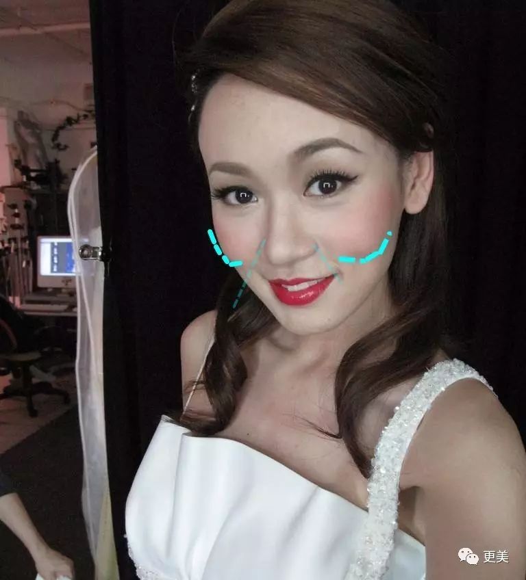 杨紫最近变美的秘诀不是瘦了而是又填充了这里