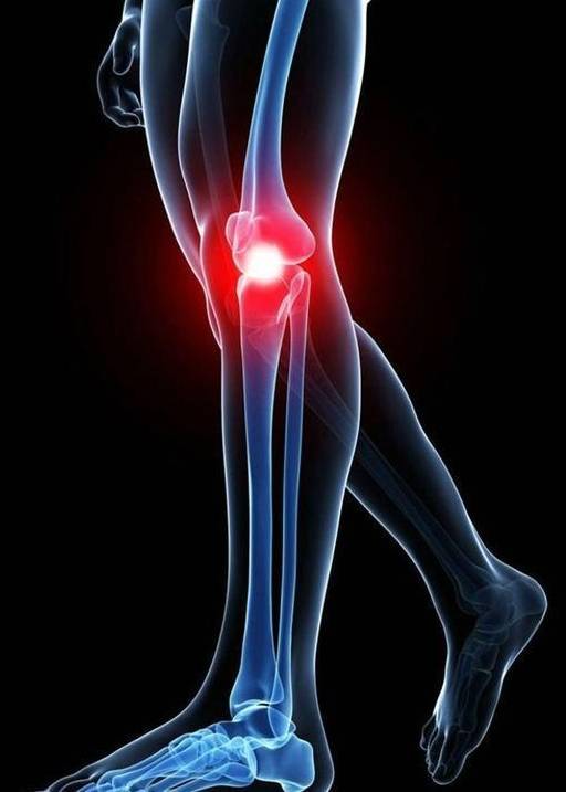 健康运动中四个容易伤膝盖的坏习惯看看你属于哪种