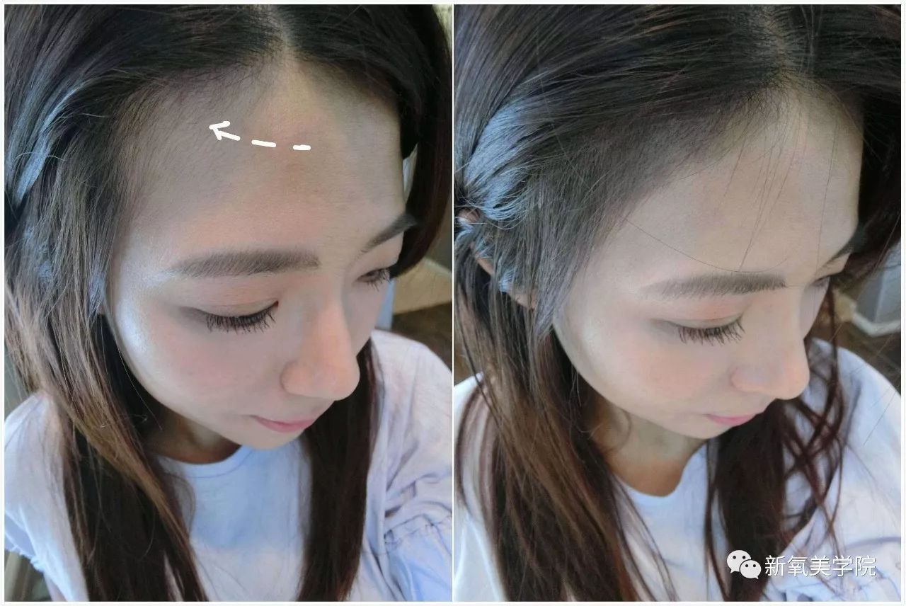 女明星们为什么不惜变寿星也要拼命填额头?