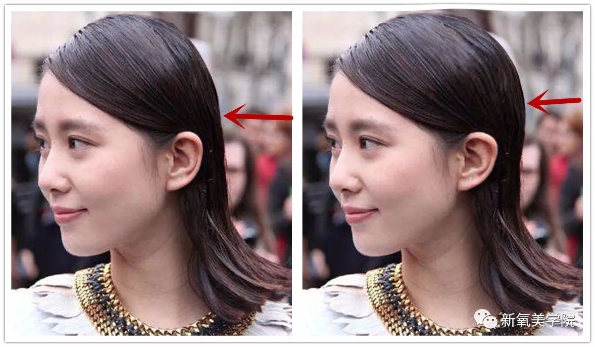 女明星们为什么不惜变寿星也要拼命填额头