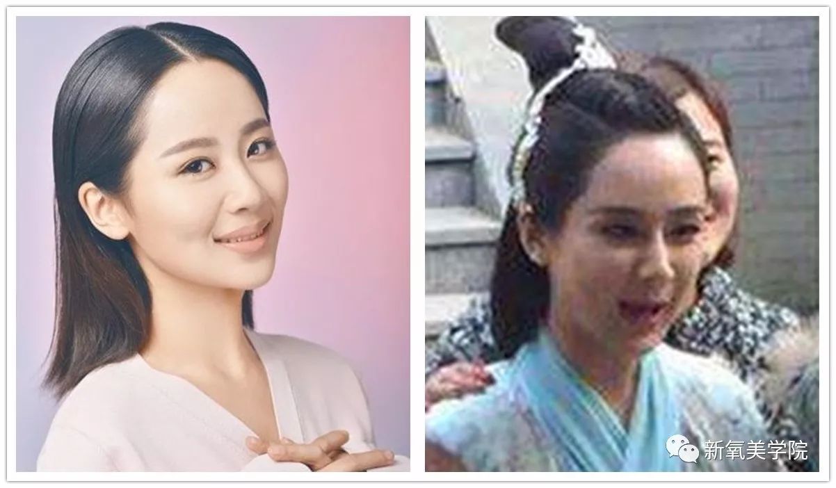 女明星们为什么不惜变寿星也要拼命填额头?