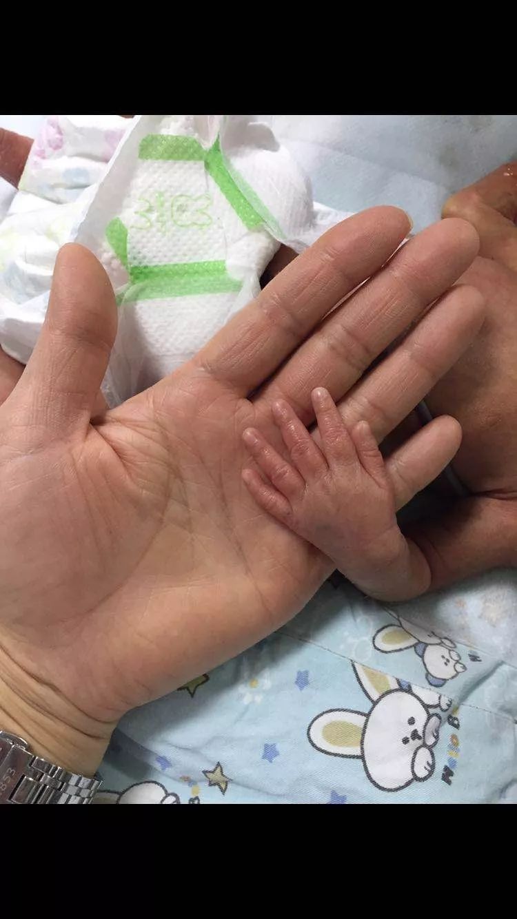 暖心女子怀双胞胎7个月时早产2斤哥哥坚强活了下来照片戳中无数人泪点