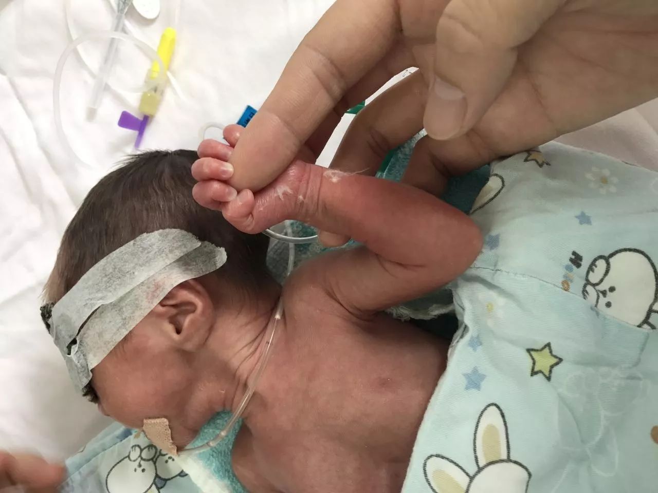 暖心女子怀双胞胎7个月时早产2斤哥哥坚强活了下来照片戳中无数人泪点