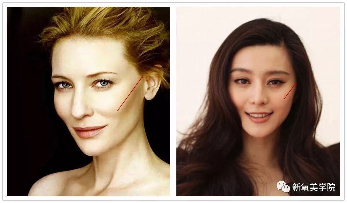 郑爽|颧骨|颧弓_新浪女性_新浪网