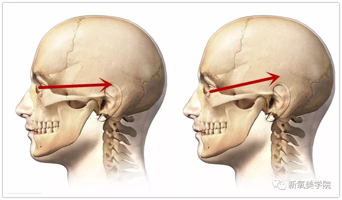 郑爽|颧骨|颧弓_新浪女性_新浪网